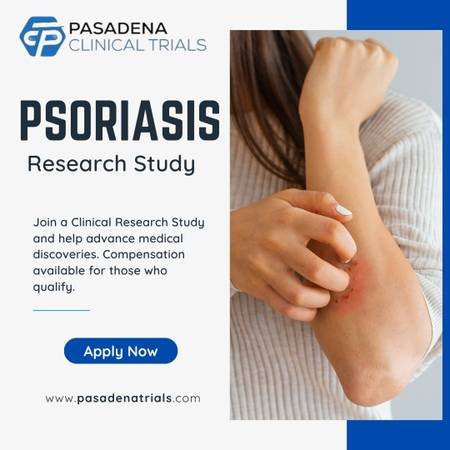 Earn Compensation for Paid Participation in a Psoriasis Clinical Study (Pasadena)