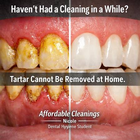 Dental hygiene student looking for patients